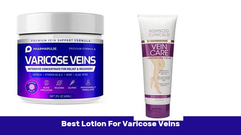 Best Lotion For Varicose Veins